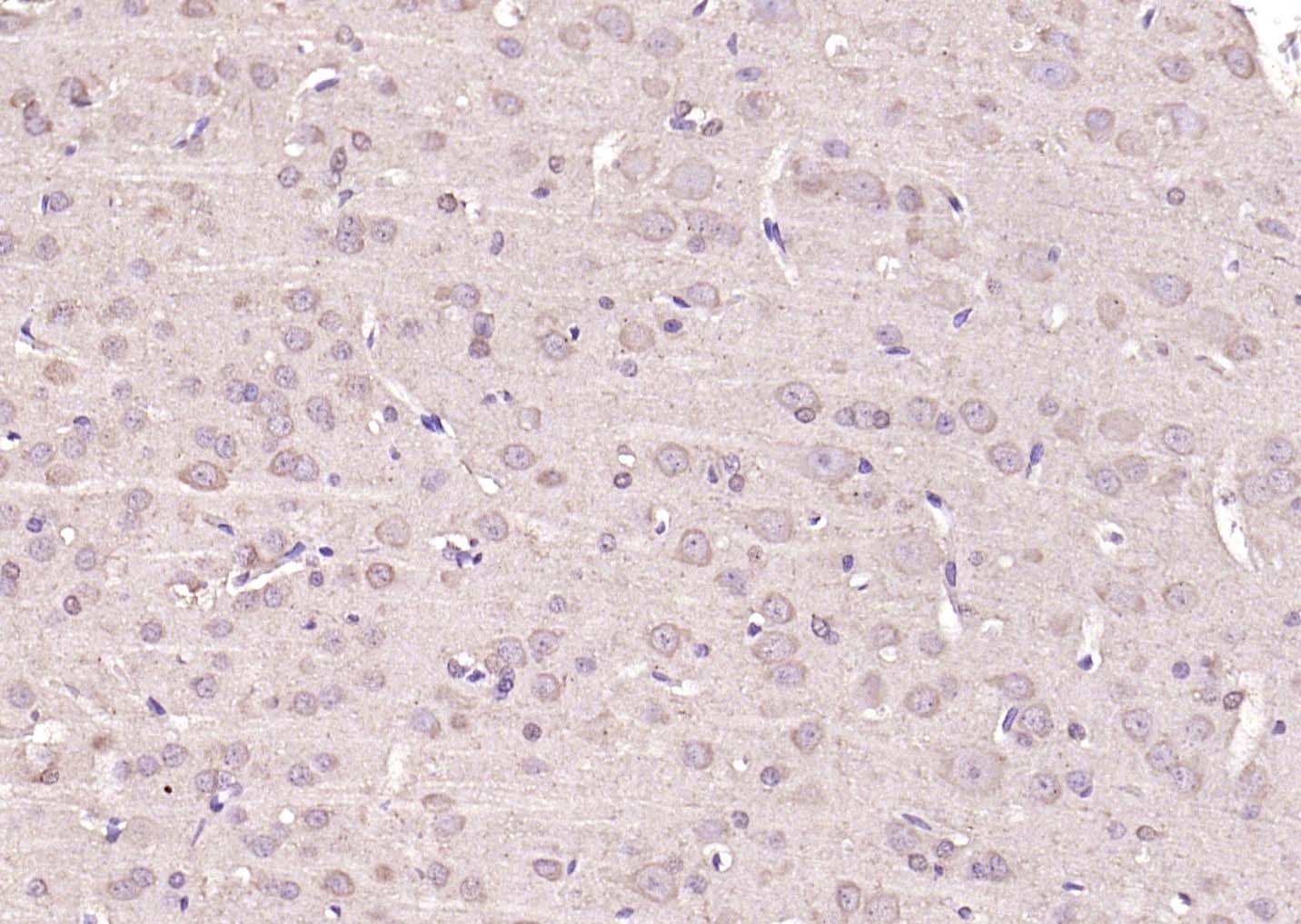 Anti-KRAS Polyclonal Antibody