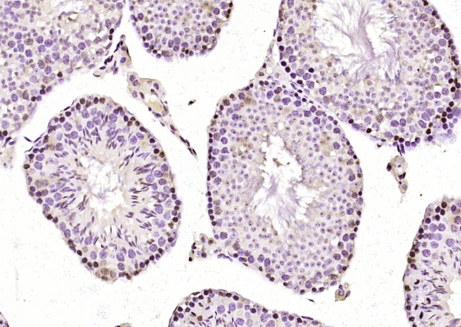 Anti-KMT2C Polyclonal Antibody