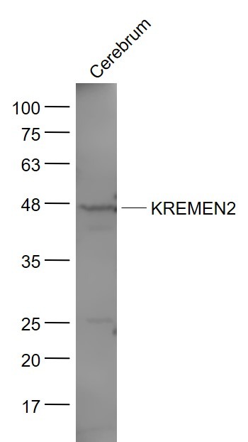 Anti-Kremen-2 Polyclonal Antibody