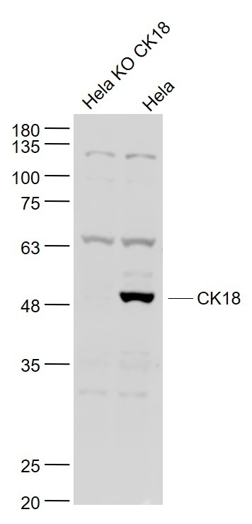 Anti-KRT18 Polyclonal Antibody