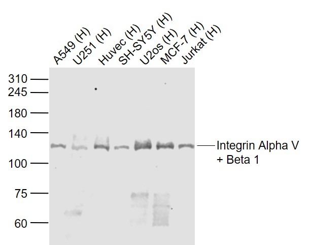 Anti-Integrin  alpha 5  beta 1 Polyclonal Antibody