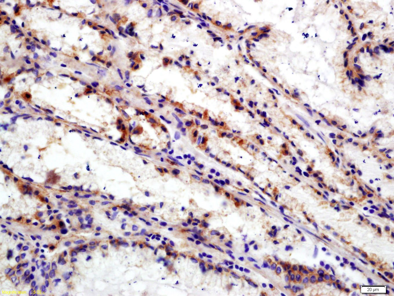 Anti-Integrin alpha 5 beta 6 Polyclonal Antibody