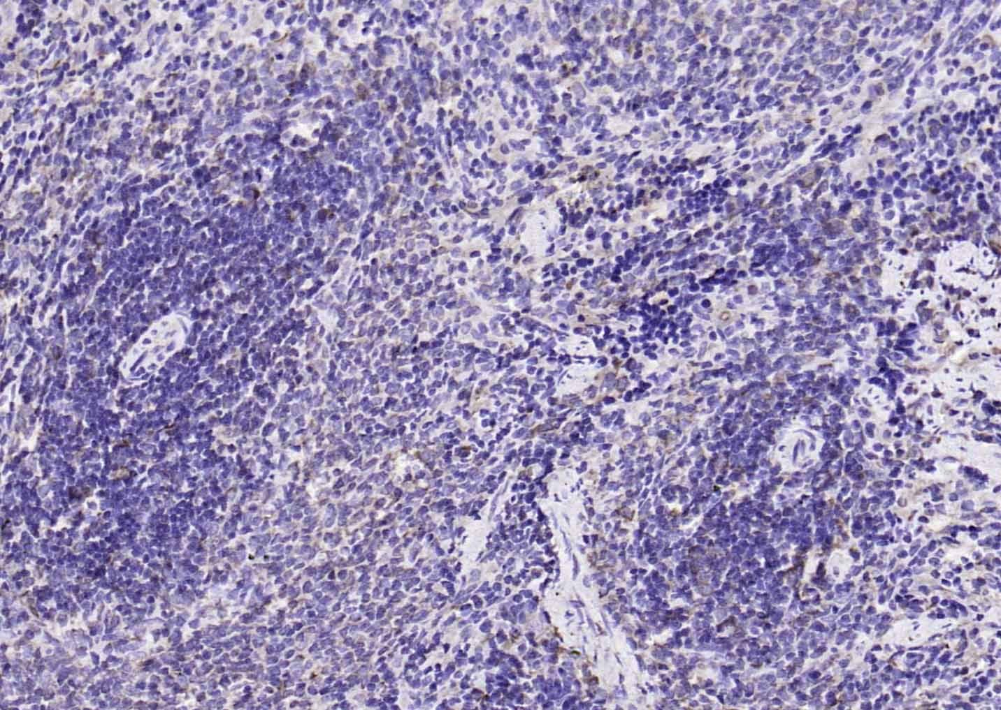 Anti-KRAS Polyclonal Antibody