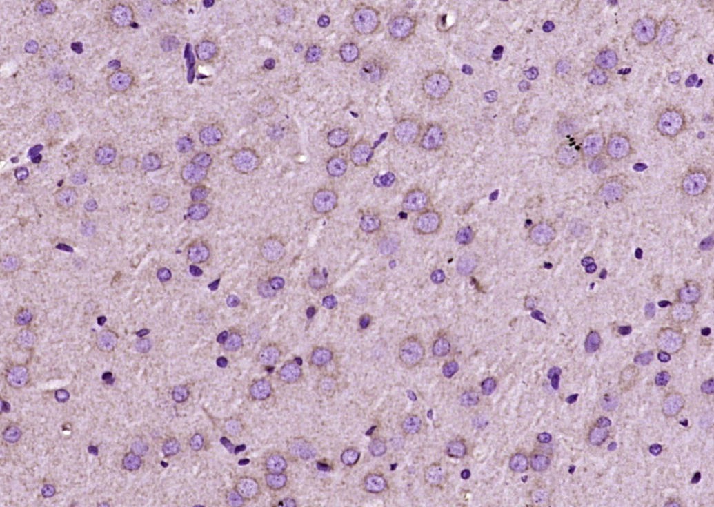 Anti-Integrin  alpha 3  beta 1 Polyclonal Antibody