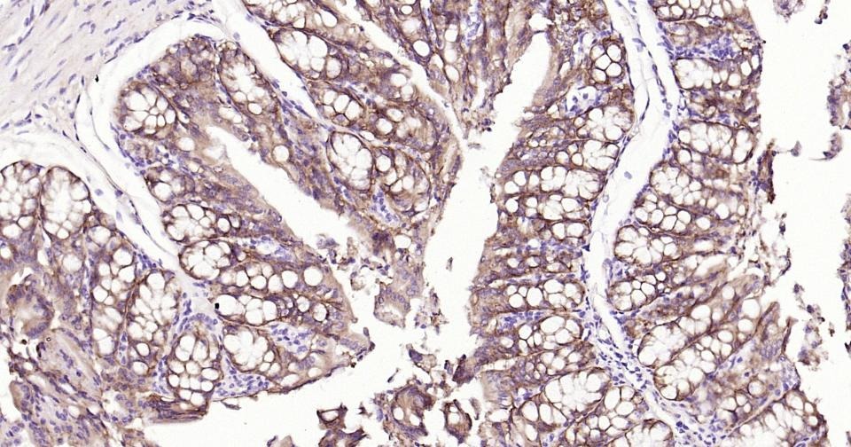 Anti-Integrin alpha 2 Antibody (8P138)