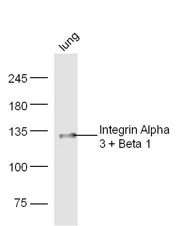 Anti-Integrin  alpha 3  beta 1 Polyclonal Antibody