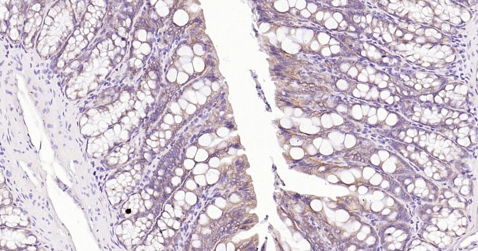 Anti-Integrin alpha 2 Antibody (8P138)