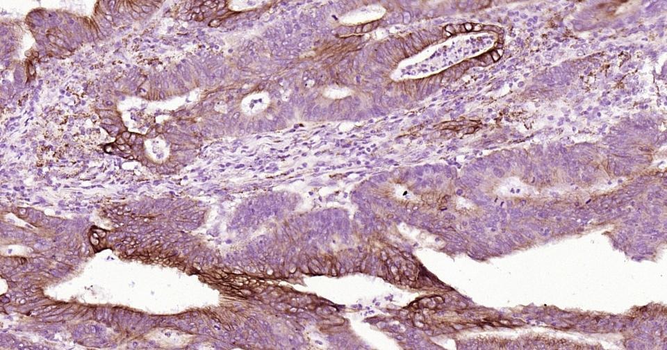 Anti-KRT19 Antibody (2L986)