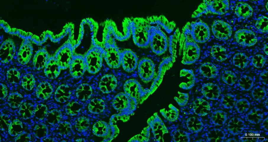 Anti-KRT19 Antibody (2L986)