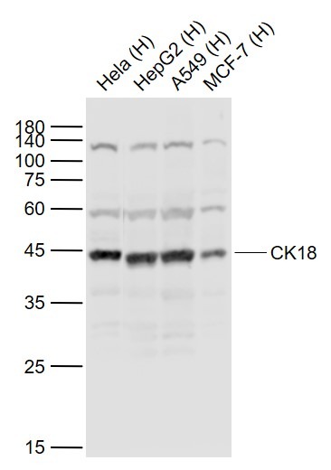 Anti-KRT18 Polyclonal Antibody 2