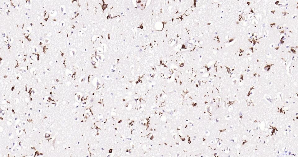 Anti-Iba1 Antibody (1N641)