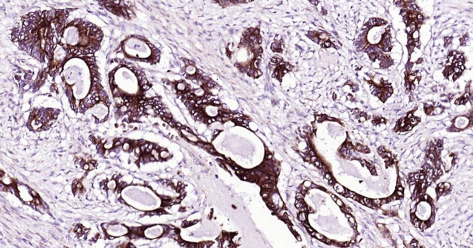 Anti-KRT19 Antibody (2L986)