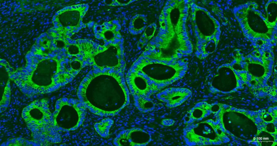 Anti-KRT19 Antibody (2L986)
