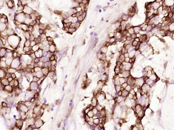 Anti-KRT19 Antibody (2L986)
