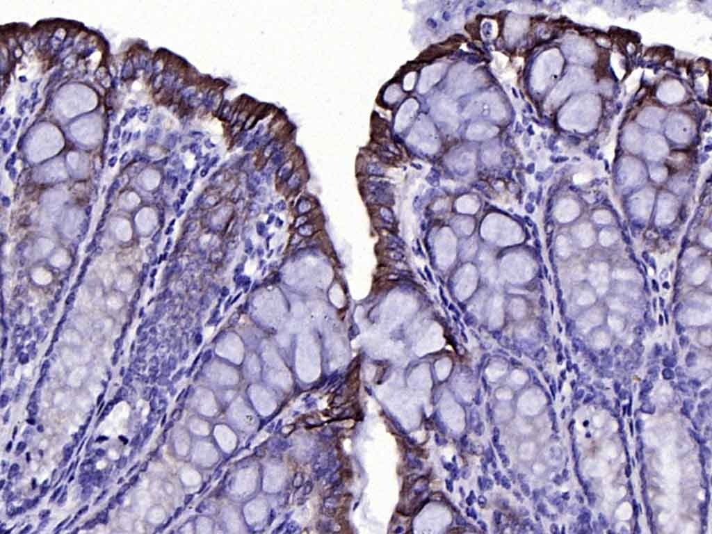Anti-KRT19 Antibody (2L986)