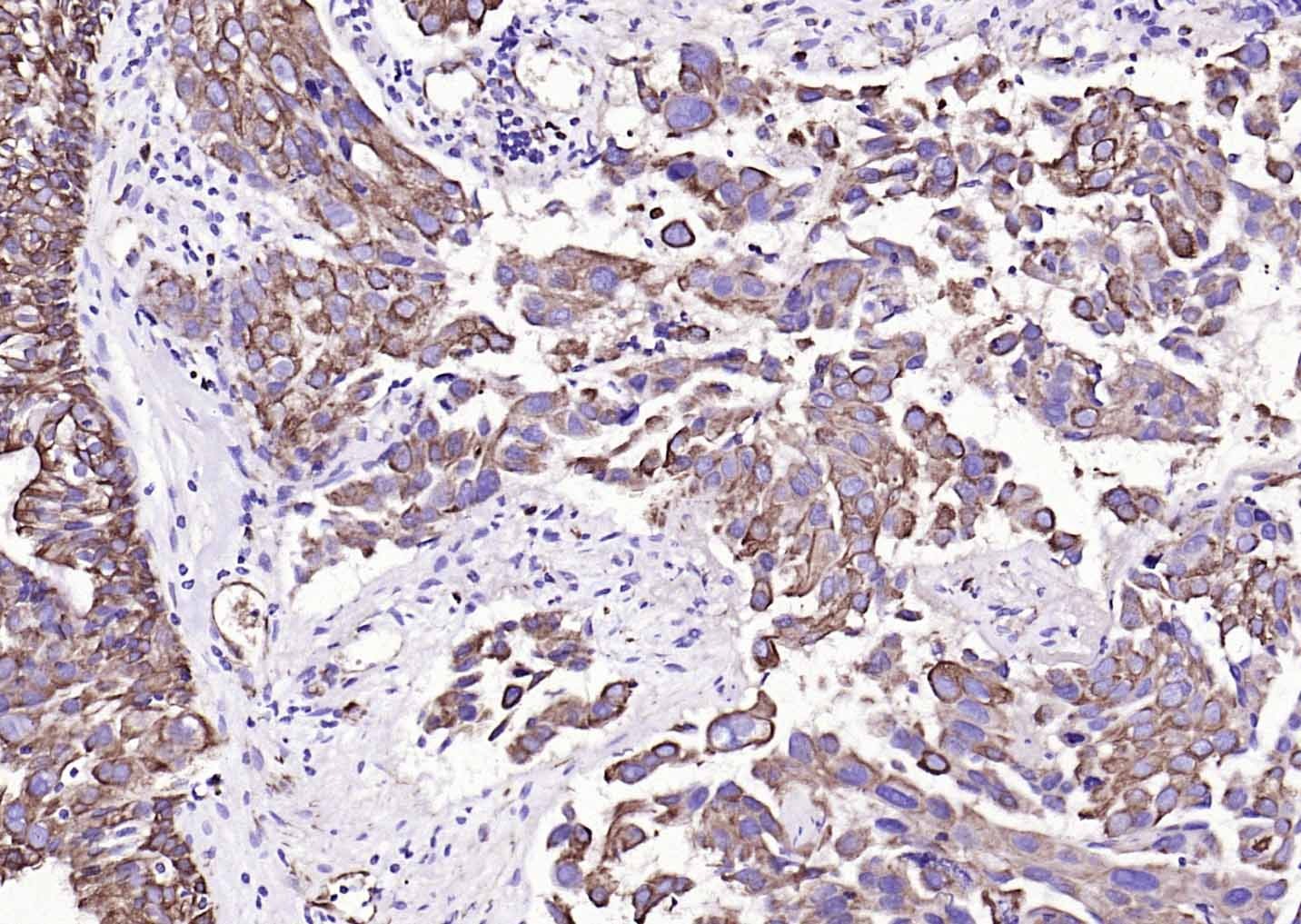 Anti-KRT19 Antibody (2L986)