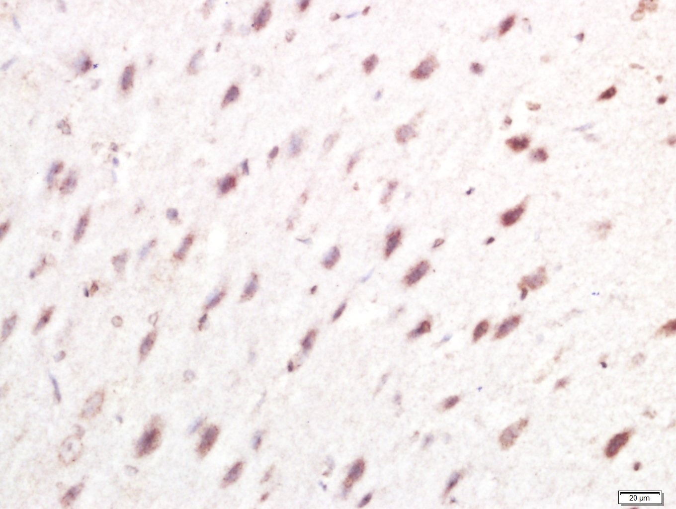 Anti-IRF7 Polyclonal Antibody