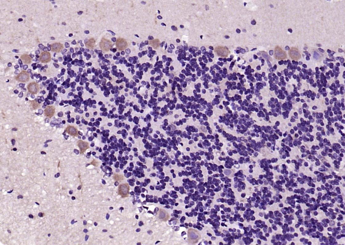 Anti-IRS1 Polyclonal Antibody