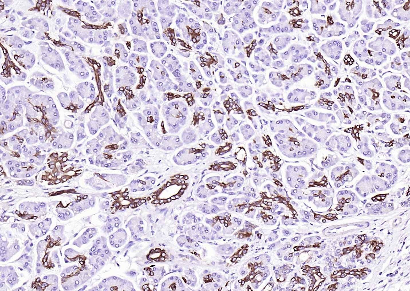 Anti-KRT19 Antibody (2L986)