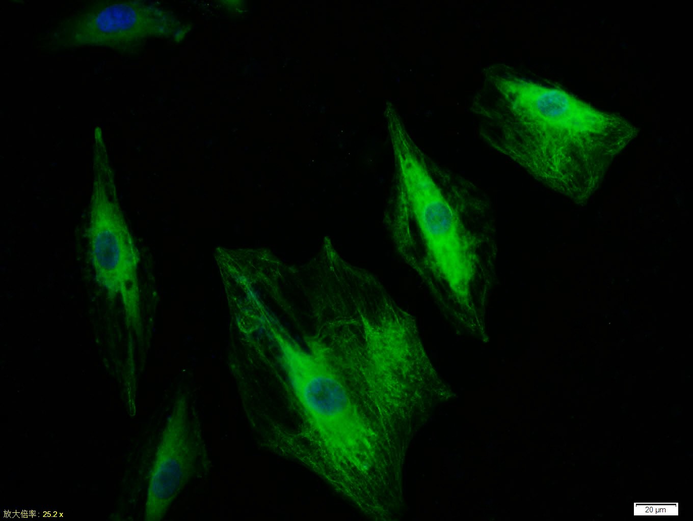 Anti-KRT18 Polyclonal Antibody 2