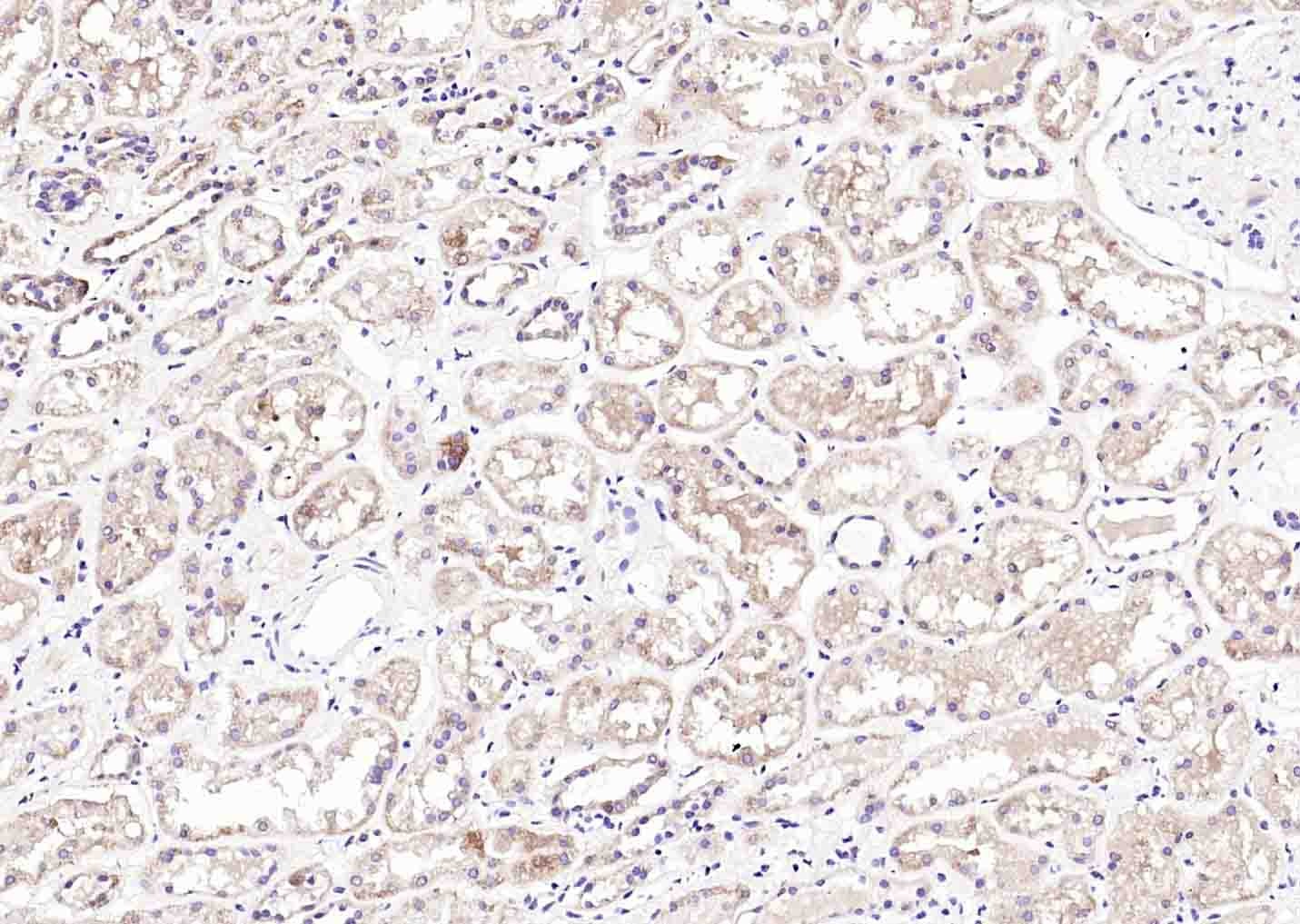 Anti-IREB2 Polyclonal Antibody