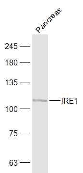 Anti-IRE1 Polyclonal Antibody
