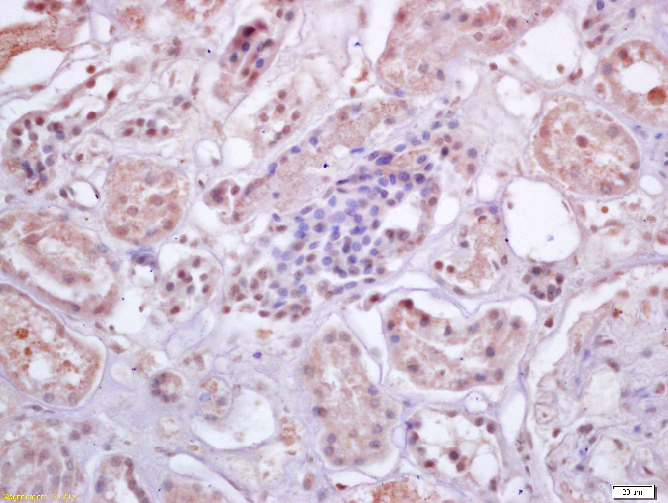 Anti-IRF3 Polyclonal Antibody