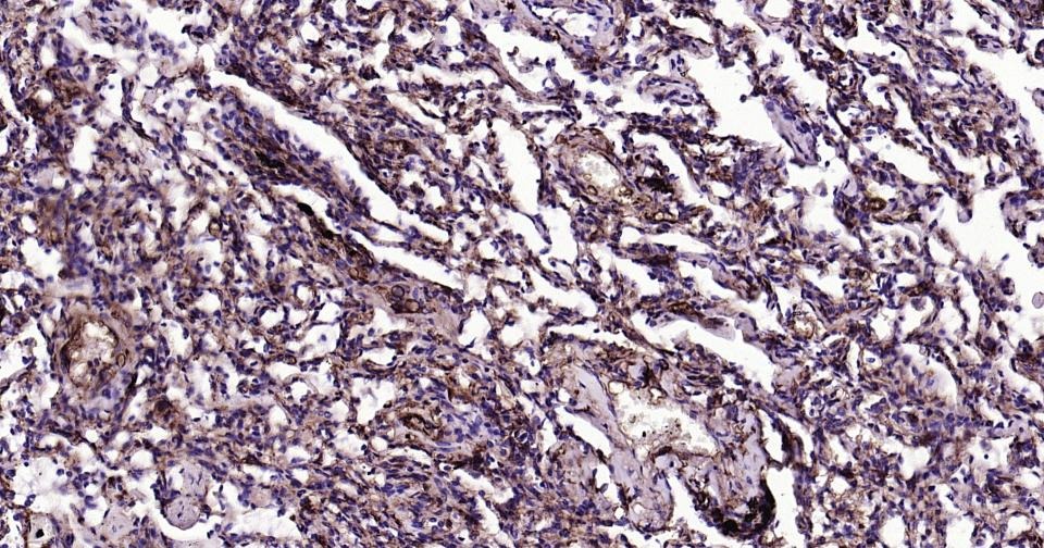Anti-CD14 Antibody (2E832)