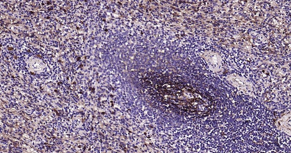 Anti-CD14 Antibody (2E832)