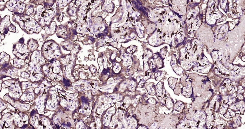 Anti-CD14 Antibody (2E832)