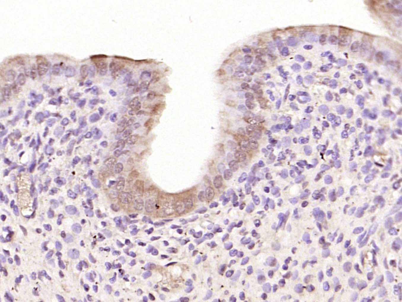 Anti-FOS Polyclonal Antibody 2