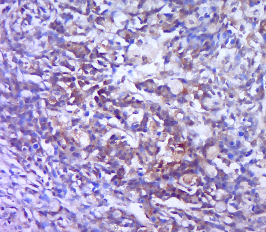 Anti-Galectin-3/LGALS3 Polyclonal Antibody