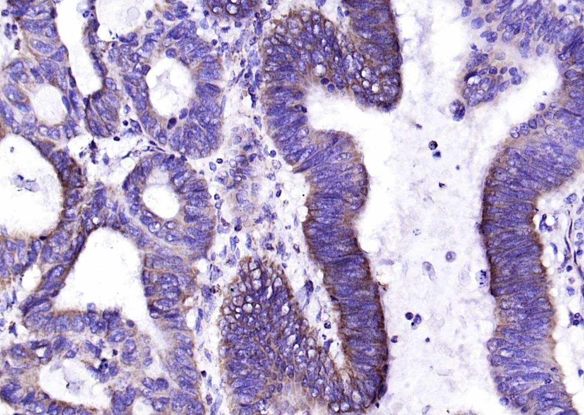 Anti-Galectin-9 Polyclonal Antibody