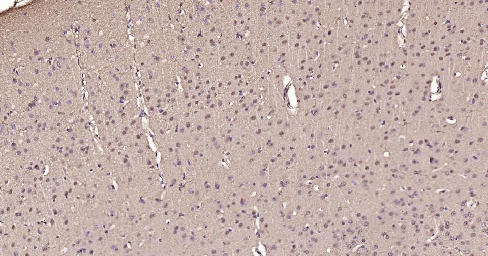 GAPDH Loading Control Polyclonal Antibody 2