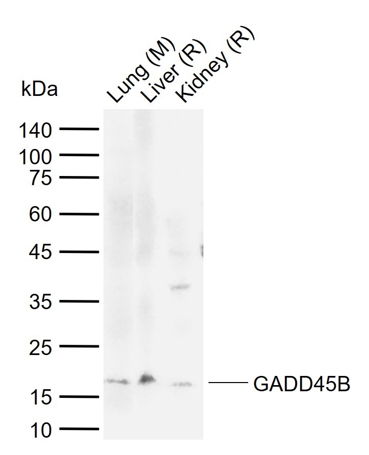 Anti-GADD45B Polyclonal Antibody