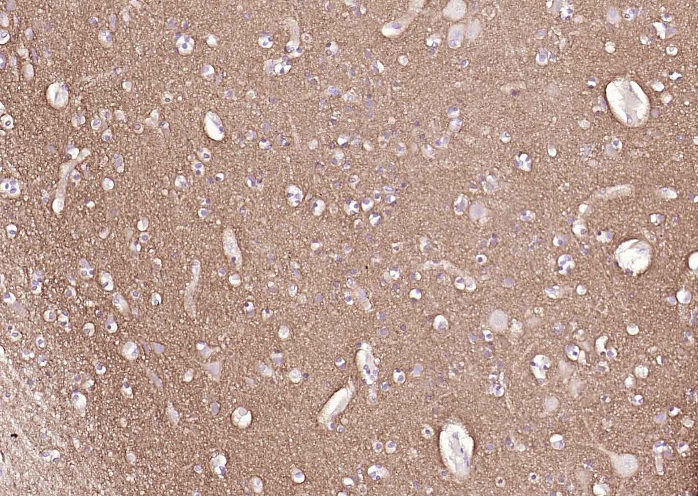 Anti-GAP43 Antibody (6V411)