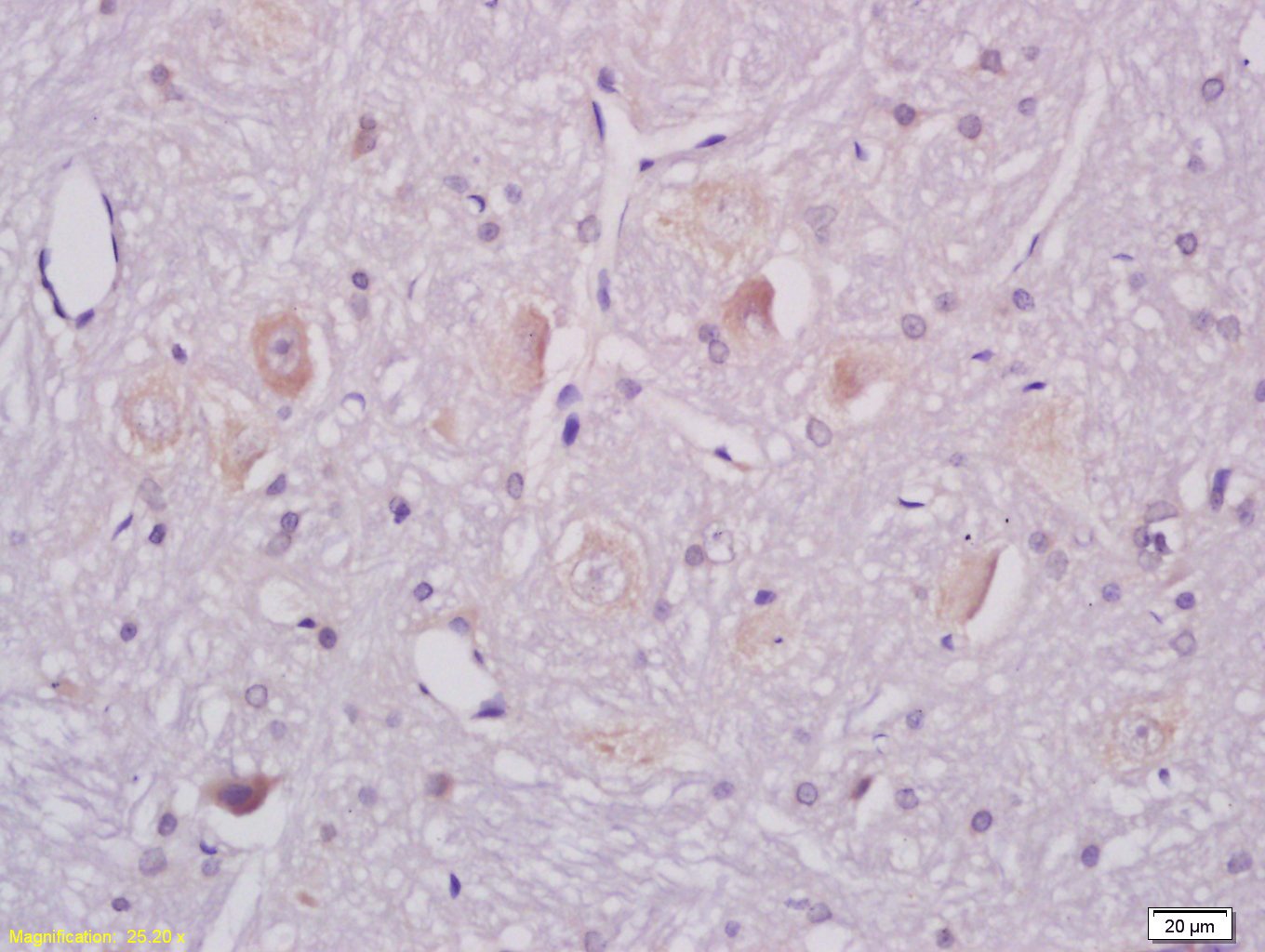 Anti-ganglioside GM1 Polyclonal Antibody