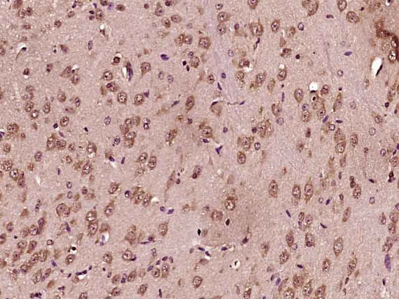 Anti-GAD67 Polyclonal Antibody