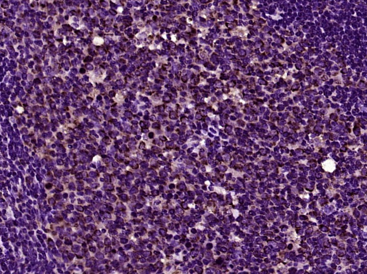 Anti-Galectin-9 Polyclonal Antibody