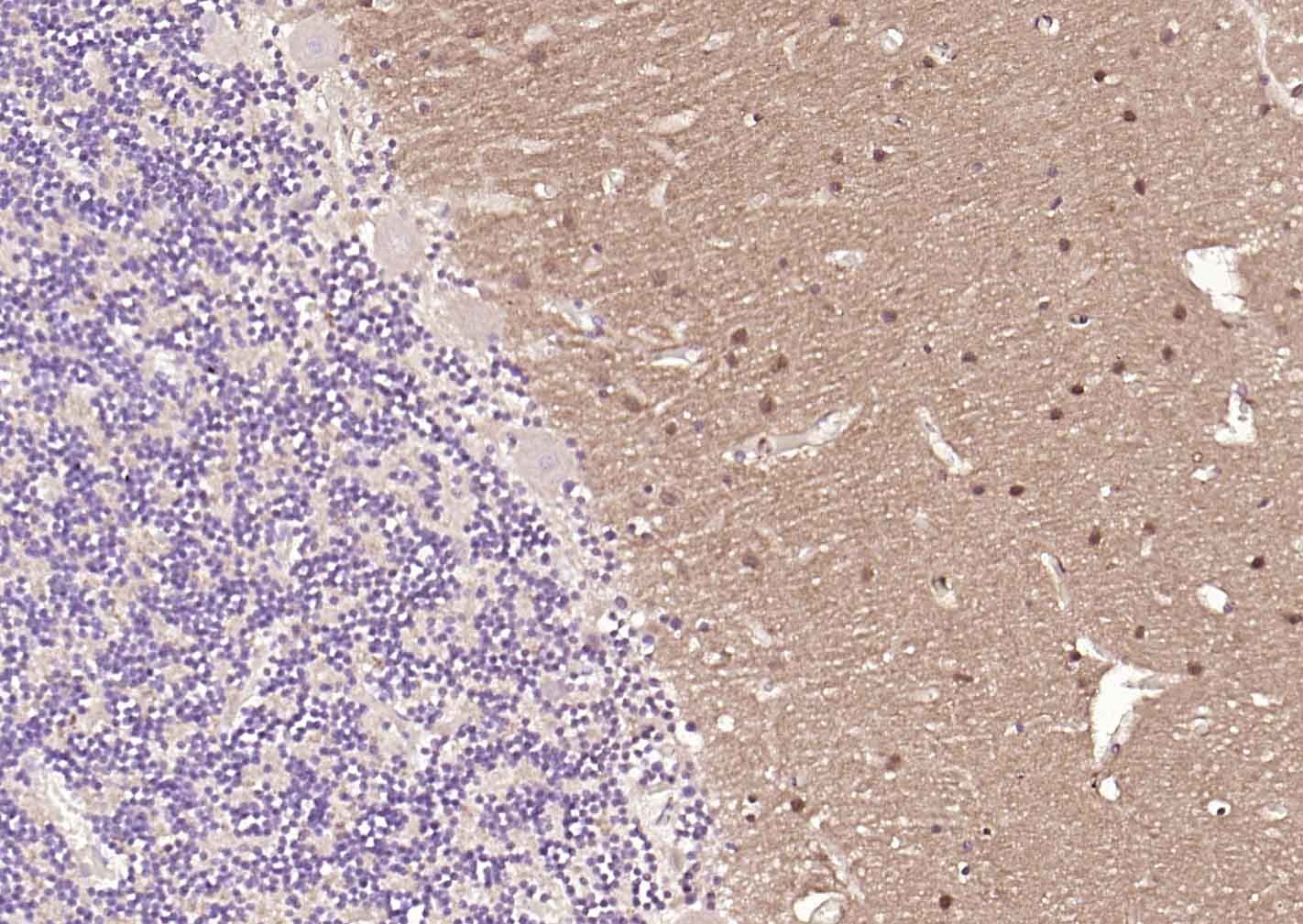 Anti-GAP43 Antibody (6V411)