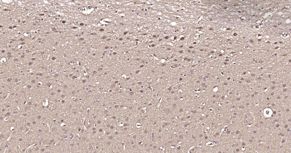 GAPDH Loading Control Polyclonal Antibody 2