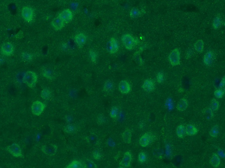 Anti-GAP43 Polyclonal Antibody