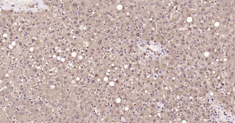 GAPDH Loading Control Polyclonal Antibody 2