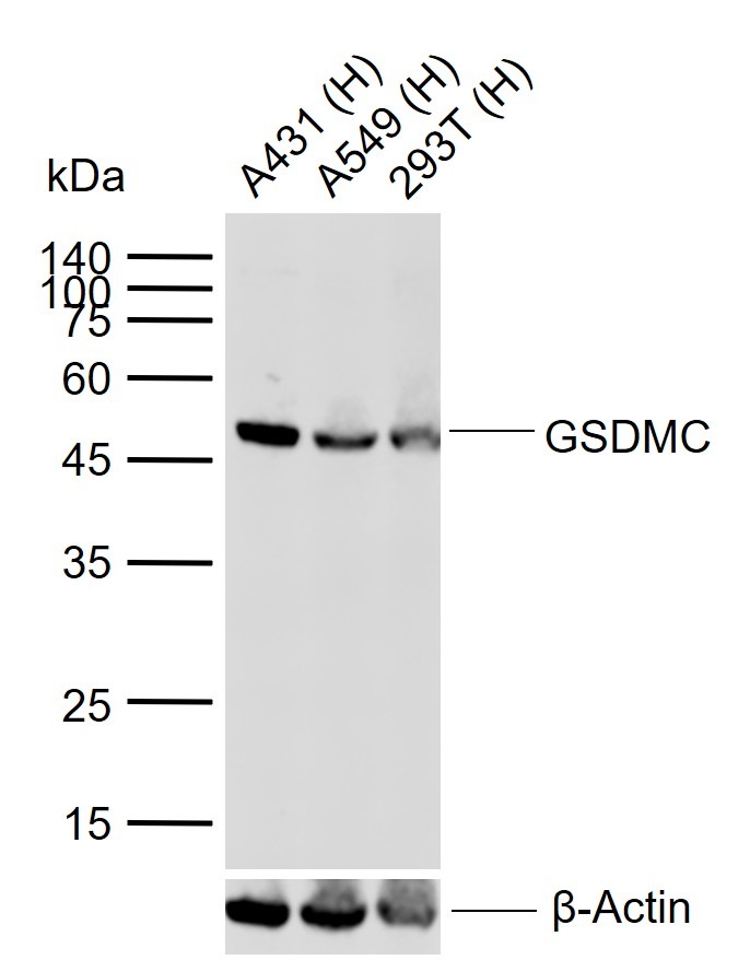 Anti-Gasdermin-C Polyclonal Antibody