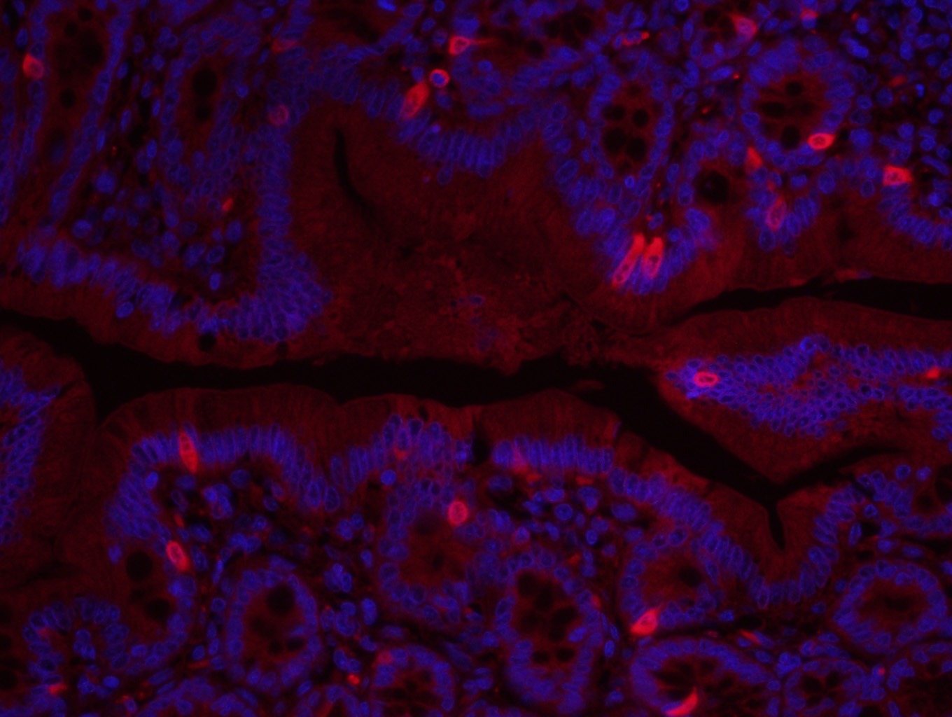 Anti-Fibronectin Polyclonal Antibody