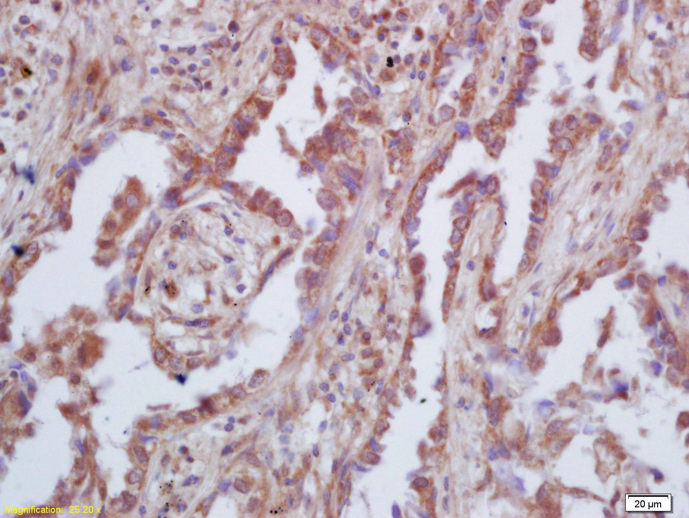 Anti-GAS6 Polyclonal Antibody