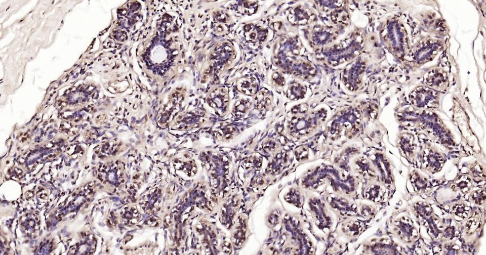 GAPDH Loading Control Polyclonal Antibody 2