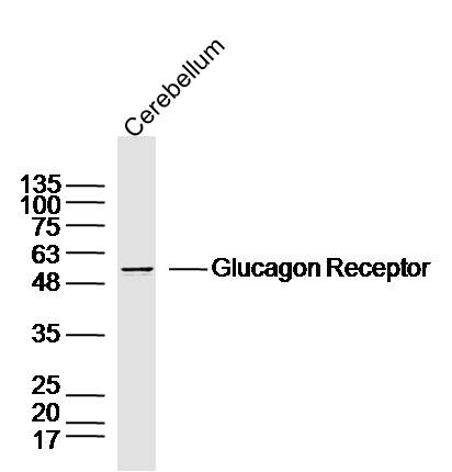 Anti-GCGR Polyclonal Antibody