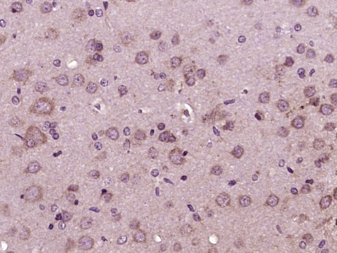 Anti-GCGR Polyclonal Antibody