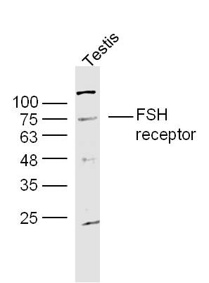Anti-FSHR Polyclonal Antibody